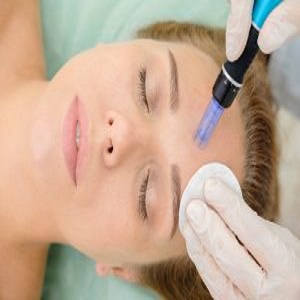 میکرودرم ابریژن