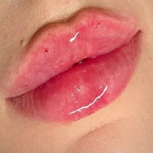 کلینیک زیبایی هُـــلــوکـــس