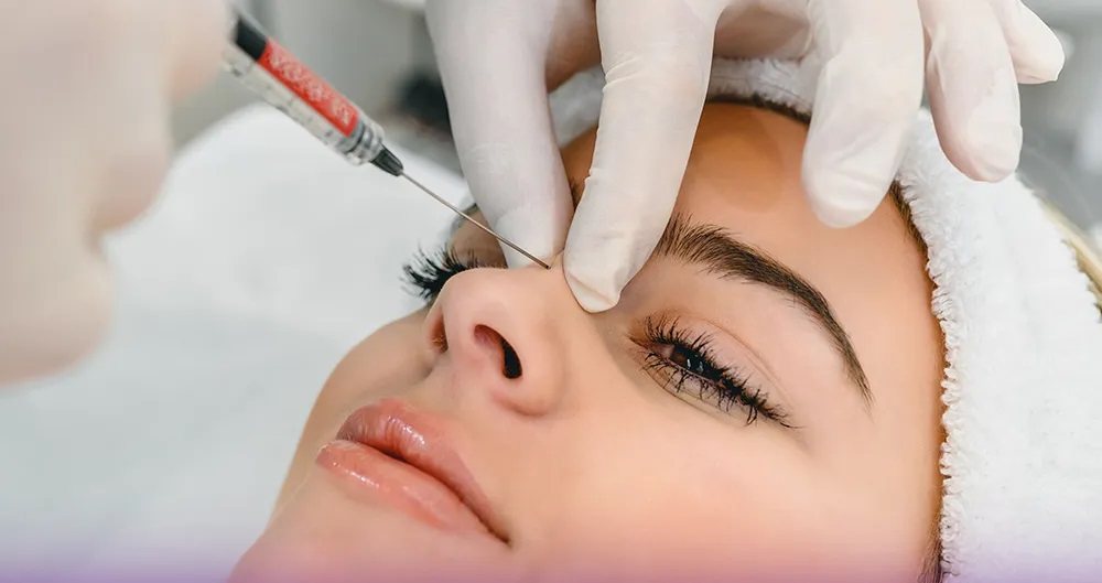 Nasal-filler-is-permanentتزریق فیلر بینی