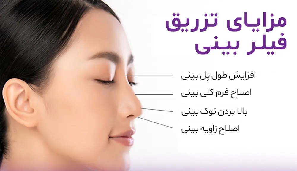 benefits-of-nose-filler-injection فیلر بینی