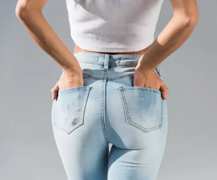 buttock-fillers- تزریق ژل باسن بادی