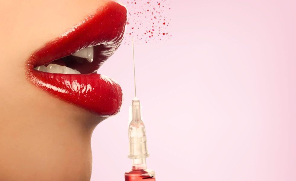 what-is-russian-lip-filler-تزریق ژل لب