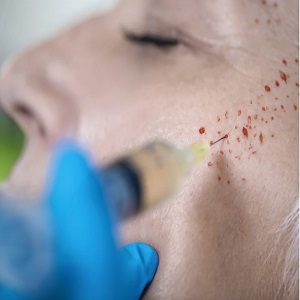 کلینیک زیبایی هُـــلــوکـــس
