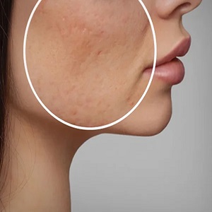 کلینیک زیبایی هُـــلــوکـــس